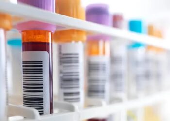 Descubren en Alemania un anticuerpo capaz de neutralizar casi todas las variantes del VIH