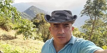 Motociclista resultó gravemente herido tras perder el control en Mamatoco