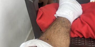 Motociclista resulta gravemente herido tras choque con camioneta en la avenida del Libertador