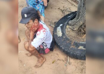 Sicarios hieren a obrero de un disparo en el cuello en Pivijay