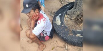 Sicarios hieren a obrero de un disparo en el cuello en Pivijay