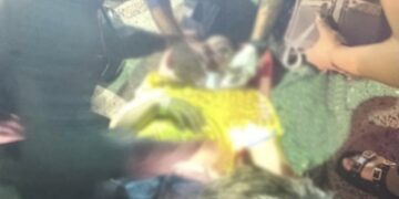 Mujer resultó herida tras accidente en el puente de El Yucal