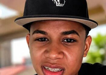 Joven motociclista lucha por su vida tras grave accidente en la vía alterna al puerto de Santa Marta