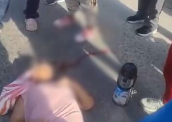 Accidente en la Troncal del Caribe: mujer resultó herida tras ser arrollada por una motocicleta en Santa Marta