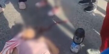 Accidente en la Troncal del Caribe: mujer resultó herida tras ser arrollada por una motocicleta en Santa Marta
