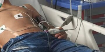 Hombre fue atacado a tiros en Villa Mónica y permanece en UCI